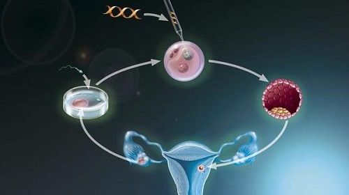 精子百分之十可以做试管婴儿吗？取精成功率为多少？